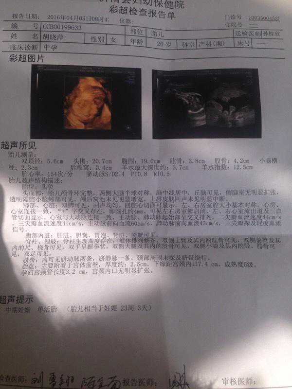 今天二胎去检查仍然是女儿，小棉袄也挺好，附怀孕症状